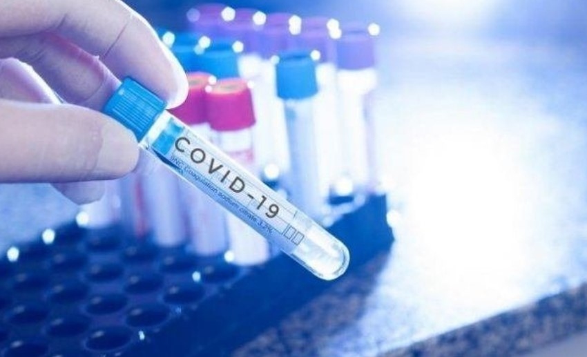 5875 са новите случаи на коронавирус